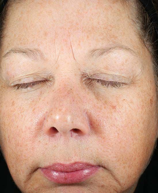 Before and After Image of results from 8 weeks of Daily Power Defense